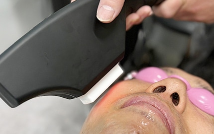 カット+髭脱毛で身だしなみもお任せ！