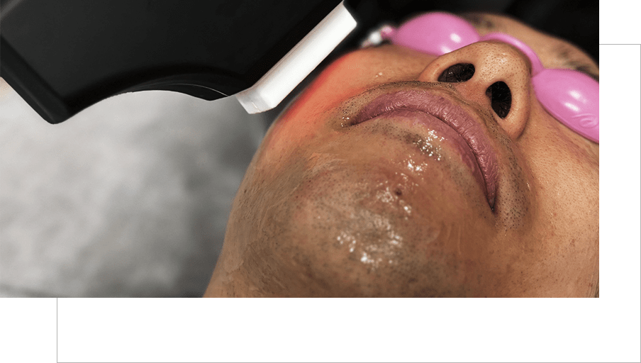 いつものカットに「脱毛」をプラスしませんか？